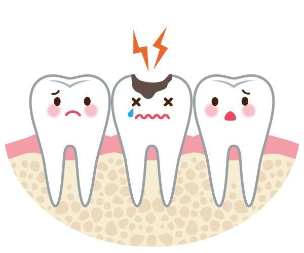 Common Adult Dental Conditions