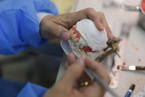 Choosing The Right Dental Professional For Denture Repair