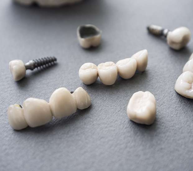 Cleveland The Difference Between Dental Implants and Mini Dental Implants