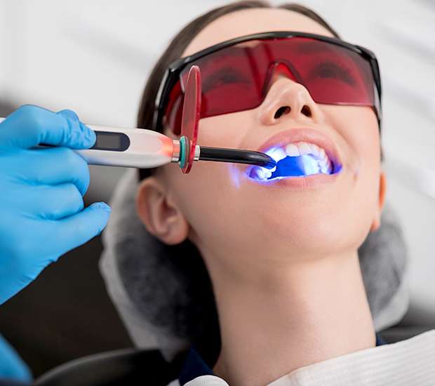 Cleveland Professional Teeth Whitening