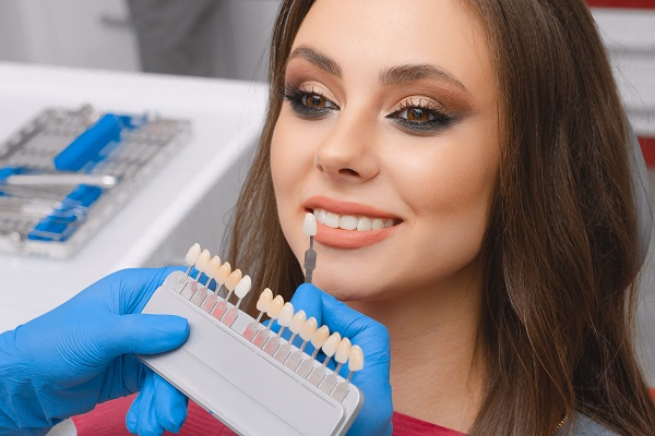 Important Information About Getting Dental Veneers